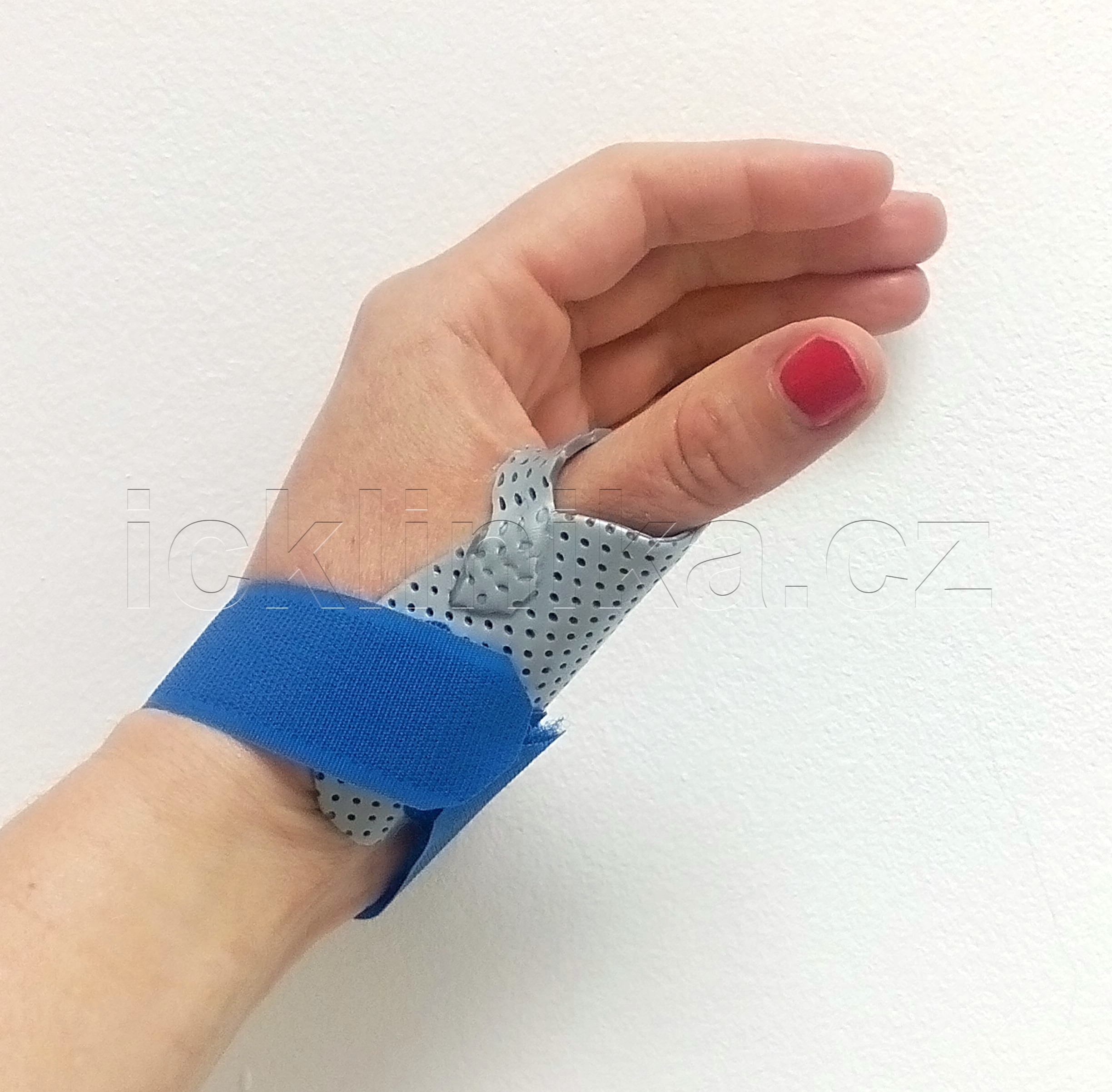 Rehabilitace ruky-revmatoidní artritida3