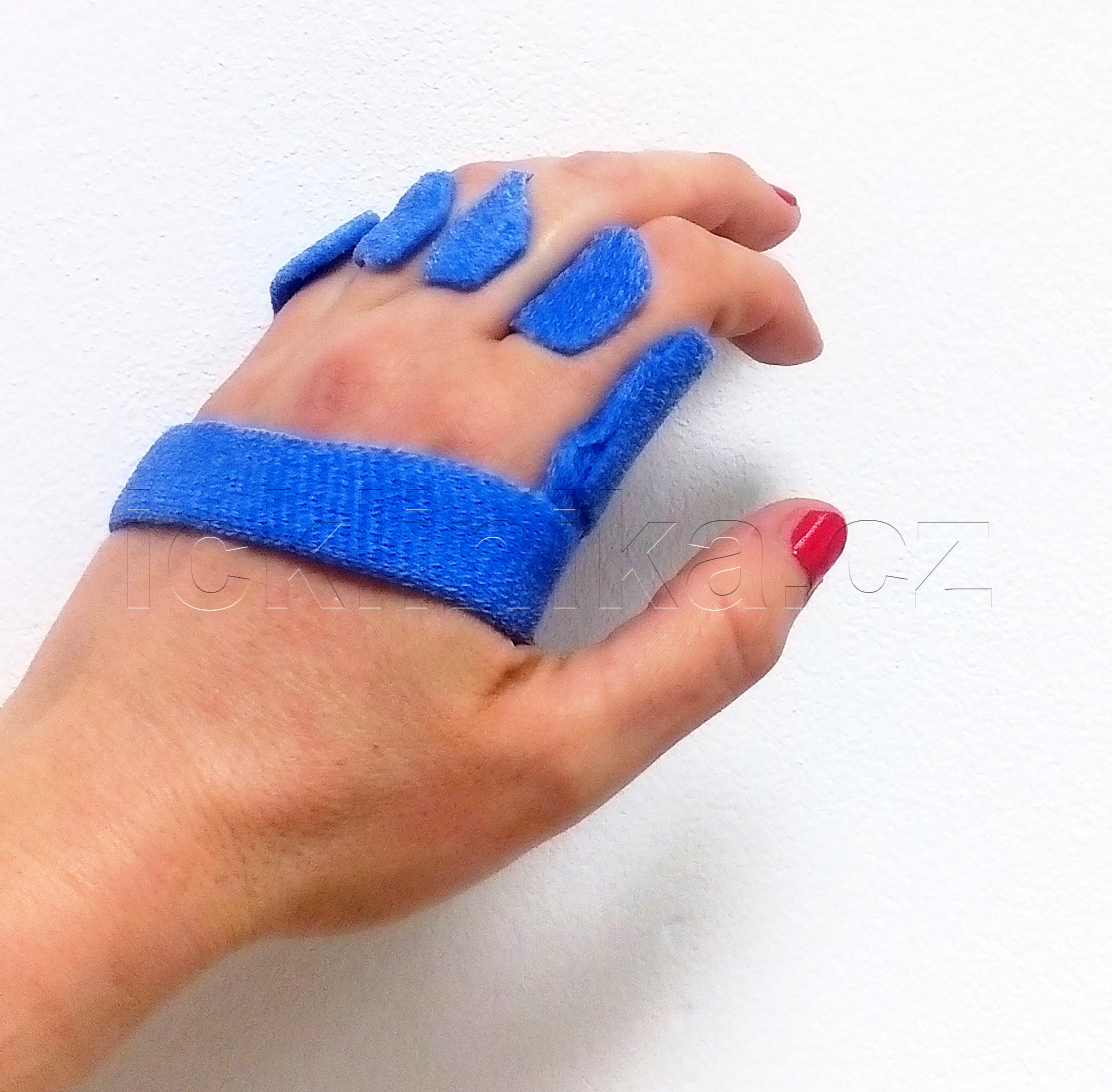 Rehabilitace ruky-revmatoidní artritida6